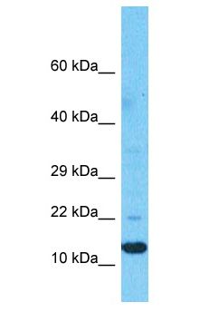 PIGP Antibody - PIGP antibody Western Blot of Fetal Liver. Antibody dilution: 1 ug/ml.  This image was taken for the unconjugated form of this product. Other forms have not been tested.