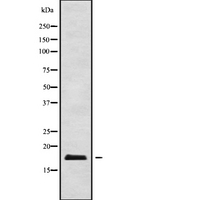 PIGP Antibody - Western blot analysis of PIGP using Jurkat whole cells lysates