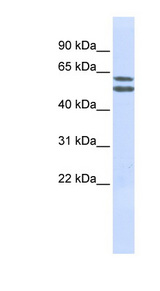 PIGQ Antibody - PIGQ antibody Western blot of Jurkat lysate. This image was taken for the unconjugated form of this product. Other forms have not been tested.