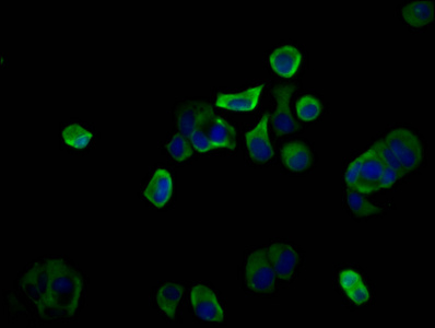 PIGQ Antibody - Immunofluorescence staining of MCF-7 cells diluted at 1:100, counter-stained with DAPI. The cells were fixed in 4% formaldehyde, permeabilized using 0.2% Triton X-100 and blocked in 10% normal Goat Serum. The cells were then incubated with the antibody overnight at 4°C.The Secondary antibody was Alexa Fluor 488-congugated AffiniPure Goat Anti-Rabbit IgG (H+L).
