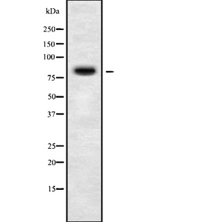 PIGQ Antibody - Western blot analysis of PIGQ using COLO205 whole cells lysates