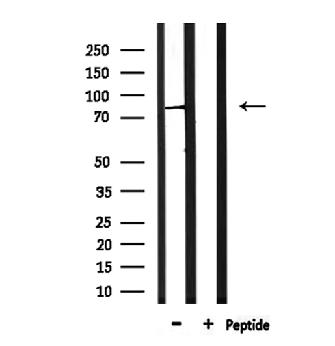 PIGQ Antibody - Western blot analysis of extracts of HepG2 cells using PIGQ antibody.