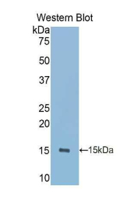 PIGR Antibody - Western blot of recombinant PIGR.  This image was taken for the unconjugated form of this product. Other forms have not been tested.