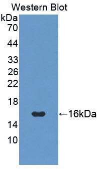 PIGR Antibody - Western Blot; Sample: Recombinant protein.