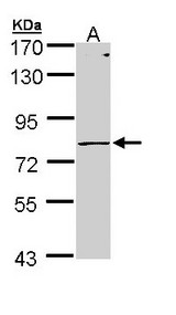 PIGR Antibody - Sample (30 ug of whole cell lysate). A: Molt-4 . 7.5% SDS PAGE. PIGR antibody diluted at 1:1000