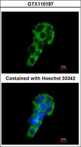 PIGR Antibody - Immunofluorescence of methanol-fixed HepG2 using PIGR antibody at 1:200 dilution.