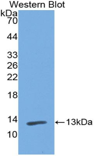 PIGR Antibody - Western blot of PIGR antibody.