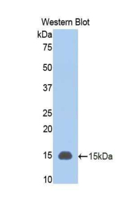 PIGR Antibody - Western blot of recombinant PIGR.  This image was taken for the unconjugated form of this product. Other forms have not been tested.