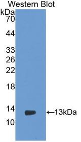 PIGR Antibody - Western Blot; Sample: Recombinant protein.