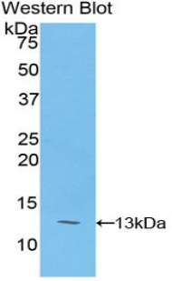 PIGR Antibody - Western blot of recombinant PIGR.  This image was taken for the unconjugated form of this product. Other forms have not been tested.