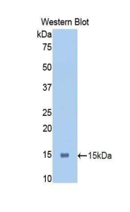 PIGR Antibody - Western blot of recombinant PIGR.  This image was taken for the unconjugated form of this product. Other forms have not been tested.