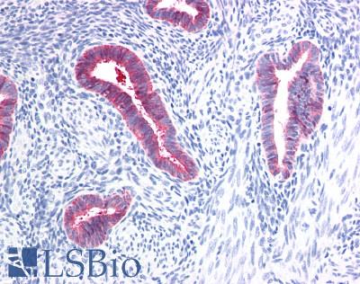 PIGR Antibody - Human Uterus: Formalin-Fixed, Paraffin-Embedded (FFPE)