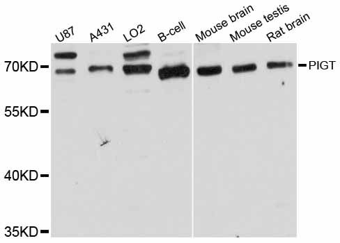 PIGT Antibody - Western blot analysis of extracts of various cell lines, using PIGT antibody at 1:3000 dilution. The secondary antibody used was an HRP Goat Anti-Rabbit IgG (H+L) at 1:10000 dilution. Lysates were loaded 25ug per lane and 3% nonfat dry milk in TBST was used for blocking. An ECL Kit was used for detection and the exposure time was 60s.