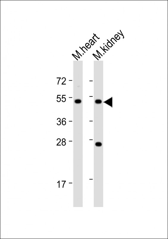 PIGU Antibody - All lanes: Anti-PIGU Antibody (N-Term) at 1:2000 dilution. Lane 1: mouse heart lysate. Lane 2: mouse kidney lysate Lysates/proteins at 20 ug per lane. Secondary Goat Anti-Rabbit IgG, (H+L), Peroxidase conjugated at 1:10000 dilution. Predicted band size: 50 kDa. Blocking/Dilution buffer: 5% NFDM/TBST.