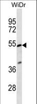 PIGV Antibody - PIGV Antibody western blot of WiDr cell line lysates (35 ug/lane). The PIGV antibody detected the PIGV protein (arrow).