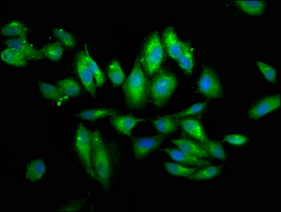 PIGV Antibody - Immunofluorescence staining of Hela cells at a dilution of 1:66, counter-stained with DAPI. The cells were fixed in 4% formaldehyde, permeabilized using 0.2% Triton X-100 and blocked in 10% normal Goat Serum. The cells were then incubated with the antibody overnight at 4 °C.The secondary antibody was Alexa Fluor 488-congugated AffiniPure Goat Anti-Rabbit IgG (H+L) .