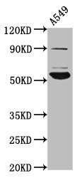 PIGV Antibody - Positive Western Blot detected in A549 whole cell lysate. All lanes: PIGV antibody at 4.6 µg/ml Secondary Goat polyclonal to rabbit IgG at 1/50000 dilution. Predicted band size: 56 KDa. Observed band size: 56 KDa