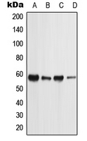 PIGW Antibody - Western blot analysis of PIGW expression in MCF7 (A); NTERA2 (B); Raw264.7 (C); H9C2 (D) whole cell lysates.