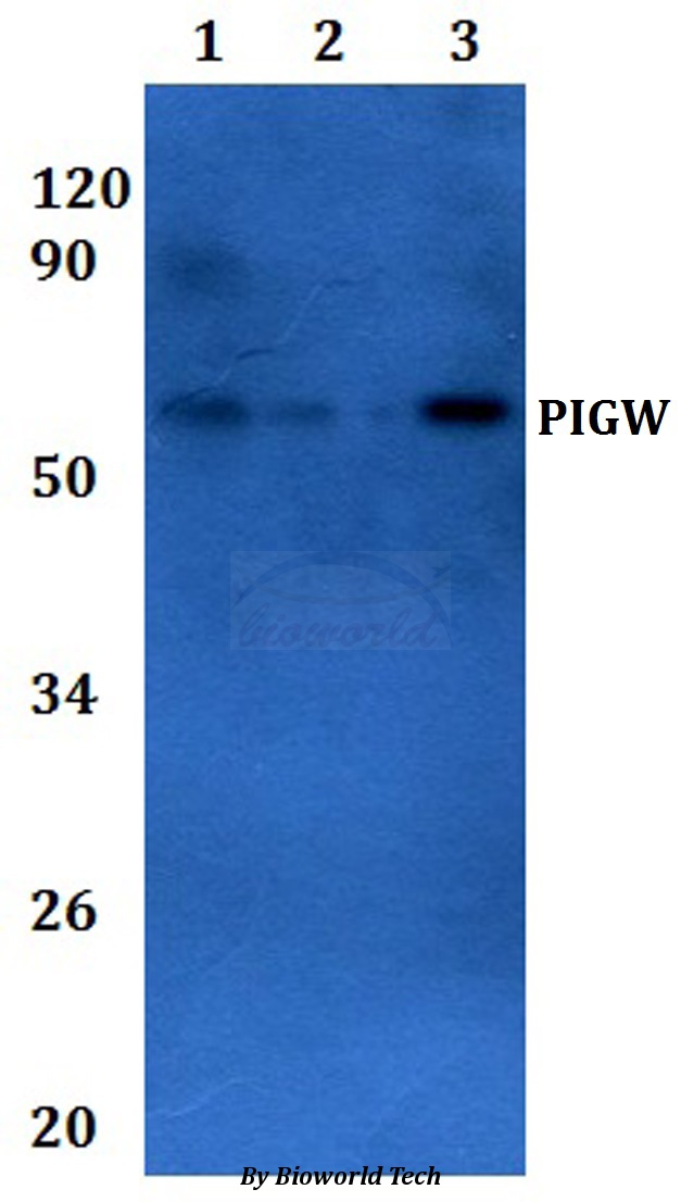 PIGW Antibody - Western blot of PIGW antibody at 1:500 dilution.