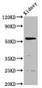 PIGW Antibody - Positive Western Blot detected in Rat kidney tissue. All lanes: PIGW antibody at 3.7 µg/ml Secondary Goat polyclonal to rabbit IgG at 1/50000 dilution. Predicted band size: 57 KDa. Observed band size: 57 KDa