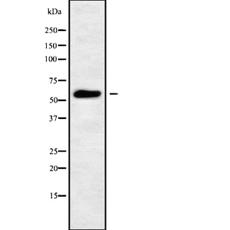PIGW Antibody - Western blot analysis of PIGW using MCF-7 whole cells lysates