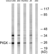 PIGX Antibody - Western blot analysis of lysates from 293, COLO, HUVEC, and Jurkat cells, using PIGX Antibody. The lane on the right is blocked with the synthesized peptide.