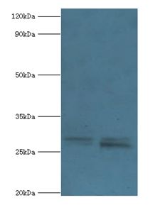 PIGX Antibody - Western blot. All lanes: Phosphatidylinositol-glycan biosynthesis class X protein antibody at 2 ug/ml Lane 1:mouse kidney tissue. Lane 2: 293T whole cell lysate. Secondary antibody: Goat polyclonal to rabbit at 1:10000 dilution.  This image was taken for the unconjugated form of this product. Other forms have not been tested.