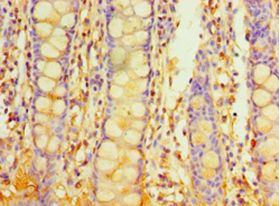 PIGX Antibody - Immunohistochemistry of paraffin-embedded human rectum tissue using antibody at 1:100 dilution.  This image was taken for the unconjugated form of this product. Other forms have not been tested.