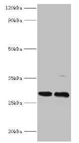 PIGX Antibody - Western blot All lanes: PIGX antibody at 2µg/ml Lane 1: Mouse kidney tissue Lane 2: 293T whole cell lysate Secondary Goat polyclonal to rabbit IgG at 1/10000 dilution Predicted band size: 29, 31 kDa Observed band size: 29 kDa