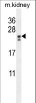 PIGX Antibody - PIGX Antibody western blot of mouse kidney tissue lysates (35 ug/lane). The PIGX antibody detected the PIGX protein (arrow).