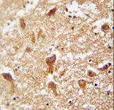 PIGX Antibody - PIGX antibody immunohistochemistry of formalin-fixed and paraffin-embedded human brain tissue followed by peroxidase-conjugated secondary antibody and DAB staining.
