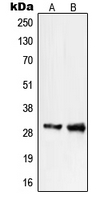 PIGX Antibody - Western blot analysis of PIGX expression in COLO205 (A); WI38 (B) whole cell lysates.