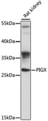 PIGX Antibody - Western blot analysis of extracts of rat kidney, using PIGX antibody at 1:1000 dilution. The secondary antibody used was an HRP Goat Anti-Rabbit IgG (H+L) at 1:10000 dilution. Lysates were loaded 25ug per lane and 3% nonfat dry milk in TBST was used for blocking. An ECL Kit was used for detection and the exposure time was 90s.