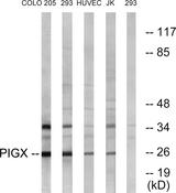 PIGX Antibody - Western blot analysis of extracts from COLO cells, 293 cells, HUVEC cells and Jurkat cells, using PIGX antibody.