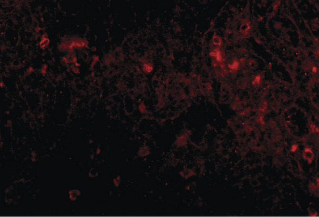 PIGY Antibody - Immunofluorescence of PIGY in human spleen tissue with PIGY1 antibody at 20 ug/ml.