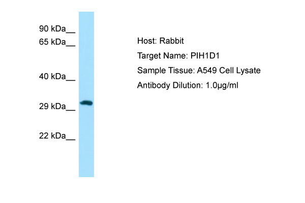 PIH1D1 Antibody -  This image was taken for the unconjugated form of this product. Other forms have not been tested.