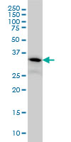 PIH1D1 Antibody - FLJ20643 monoclonal antibody (M06), clone 1E8 Western blot of FLJ20643 expression in A-431.
