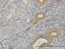 PIH1D1 Antibody - Immunoperoxidase of monoclonal antibody to FLJ20643 on formalin-fixed paraffin-embedded human endometrium. [antibody concentration 3 ug/ml]