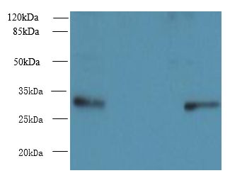 PIH1D1 Antibody - Western blot. All lanes: PIH1D1 antibody at 6 ug/ml. Lane 1: A431 whole cell lysate. Lane 2: A549 whole cell lysate. Secondary Goat polyclonal to Rabbit IgG at 1:10000 dilution. Predicted band size: 32 kDa. Observed band size: 32 kDa.