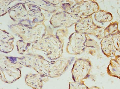 PIH1D1 Antibody - Immunohistochemistry of paraffin-embedded human placenta tissue using antibody at dilution of 1:100.