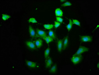 PIH1D1 Antibody - Immunofluorescence staining of Hela cells cells with PIH1D1 Antibody at 1: 200, counter-stained with DAPI. The cells were fixed in 4% formaldehyde, permeabilized tissue using 0.2% Triton X-100 and blocked in 10% normal Goat Serum. The cells were then incubated with the antibody overnight at 4°C.The secondary antibody was Alexa Fluor 488-congugated AffiniPure Goat Anti-Rabbit IgG(H+L) .