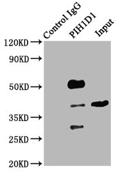 PIH1D1 Antibody - Immunoprecipitating PIH1D1 in Hela whole cell lysate Lane 1: Rabbit control IgG (1µg) instead of PIH1D1 Antibody in Hela whole cell lysate.For western blotting, a HRP-conjugated Protein G antibody was used as the secondary antibody (1/2000) Lane 2: PIH1D1 Antibody (6µg) + Hela whole cell lysate (500µg) Lane 3: Hela whole cell lysate (10µg)