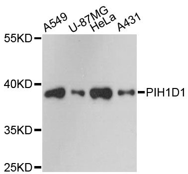 PIH1D1 Antibody - Western blot analysis of extracts of various cell lines, using PIH1D1 antibody at 1:3000 dilution. The secondary antibody used was an HRP Goat Anti-Rabbit IgG (H+L) at 1:10000 dilution. Lysates were loaded 25ug per lane and 3% nonfat dry milk in TBST was used for blocking. An ECL Kit was used for detection and the exposure time was 90s.
