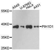PIH1D1 Antibody - Western blot analysis of extracts of various cell lines, using PIH1D1 antibody at 1:3000 dilution. The secondary antibody used was an HRP Goat Anti-Rabbit IgG (H+L) at 1:10000 dilution. Lysates were loaded 25ug per lane and 3% nonfat dry milk in TBST was used for blocking. An ECL Kit was used for detection and the exposure time was 90s.
