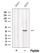 PIH1D1 Antibody - Western blot analysis of extracts of HeLa cells using PIH1D1 antibody. The lane on the left was treated with blocking peptide.