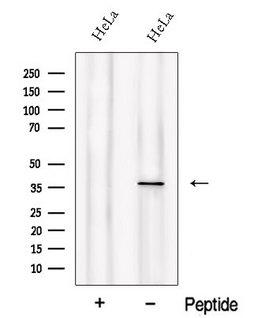 PIH1D1 Antibody - Western blot analysis of extracts of HeLa cells using PIH1D1 antibody. The lane on the left was treated with blocking peptide.