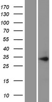 PIH1D1 Protein - Western validation with an anti-DDK antibody * L: Control HEK293 lysate R: Over-expression lysate