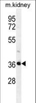 PIH1D2 Antibody - PIH1D2 Antibody western blot of mouse kidney tissue lysates (35 ug/lane). The PIH1D2 antibody detected the PIH1D2 protein (arrow).