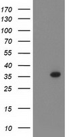 PIH1D2 Antibody - HEK293T cells were transfected with the pCMV6-ENTRY control (Left lane) or pCMV6-ENTRY PIH1D2 (Right lane) cDNA for 48 hrs and lysed. Equivalent amounts of cell lysates (5 ug per lane) were separated by SDS-PAGE and immunoblotted with anti-PIH1D2.