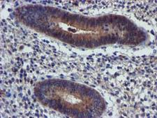 PIH1D2 Antibody - IHC of paraffin-embedded Human endometrium tissue using anti-PIH1D2 mouse monoclonal antibody.